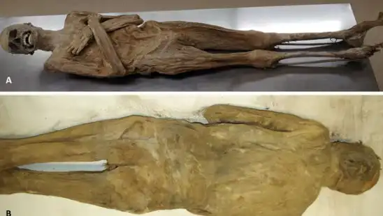 Eski Mısır'ın Sırlarını Ortaya Koyan Kurutulmuş Papazın Mumyası İle İlgili Şaşırtıcı Gerçekler