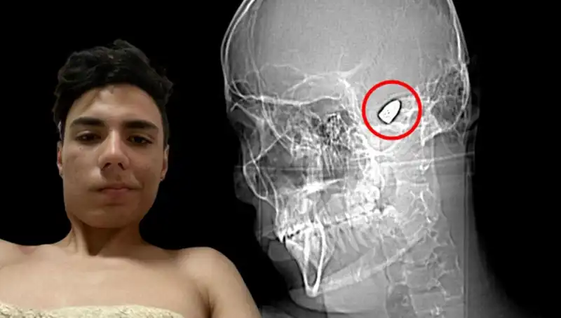 Kafasında Patlayan Düşünceler: Bomba Kafasıyla Yaşamak Nedir?