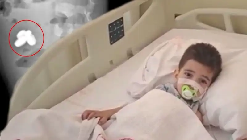 Küçük Çocuğun Midesinde Yaşanan Korkutucu Olay: Pil ve Mıknatıs Yuttu